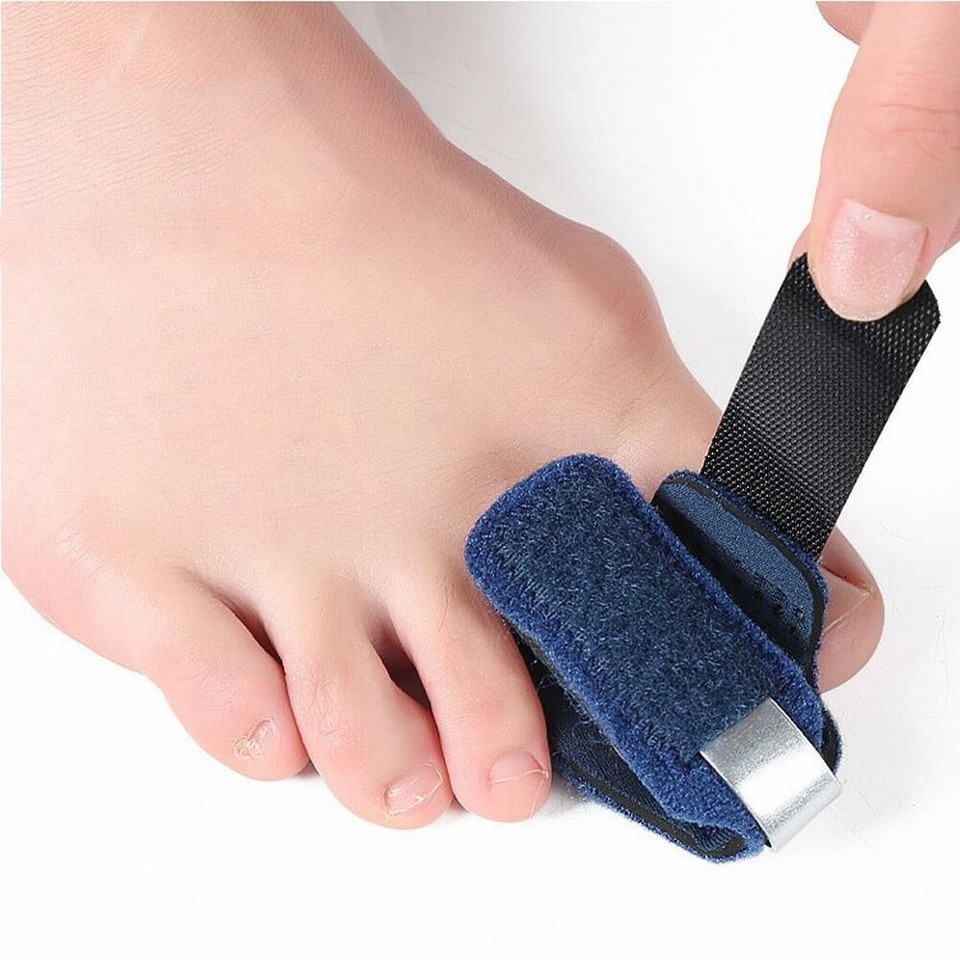Hammer Toe Corrector Bandage Aluminum Plates Fixation Portable and