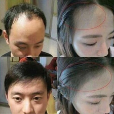 WEILAIYA Set Shampoo 400ML and Conditioner 250ML HAIR LOSS, FREE MINI SET