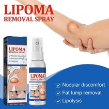 1-5PC Lipomheilung Reduction Spray,Instant LumpFree Lipoma Removal Spray USA Hot