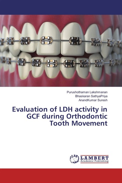 Evaluation Of LDH Activity In GCF During Orthodontic Tooth Movement Taschenbuch-image