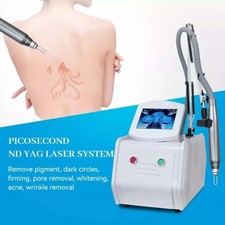 Nd Yag Laser Tattoo Removal Machine for Skin Whitening Beauty Equipment