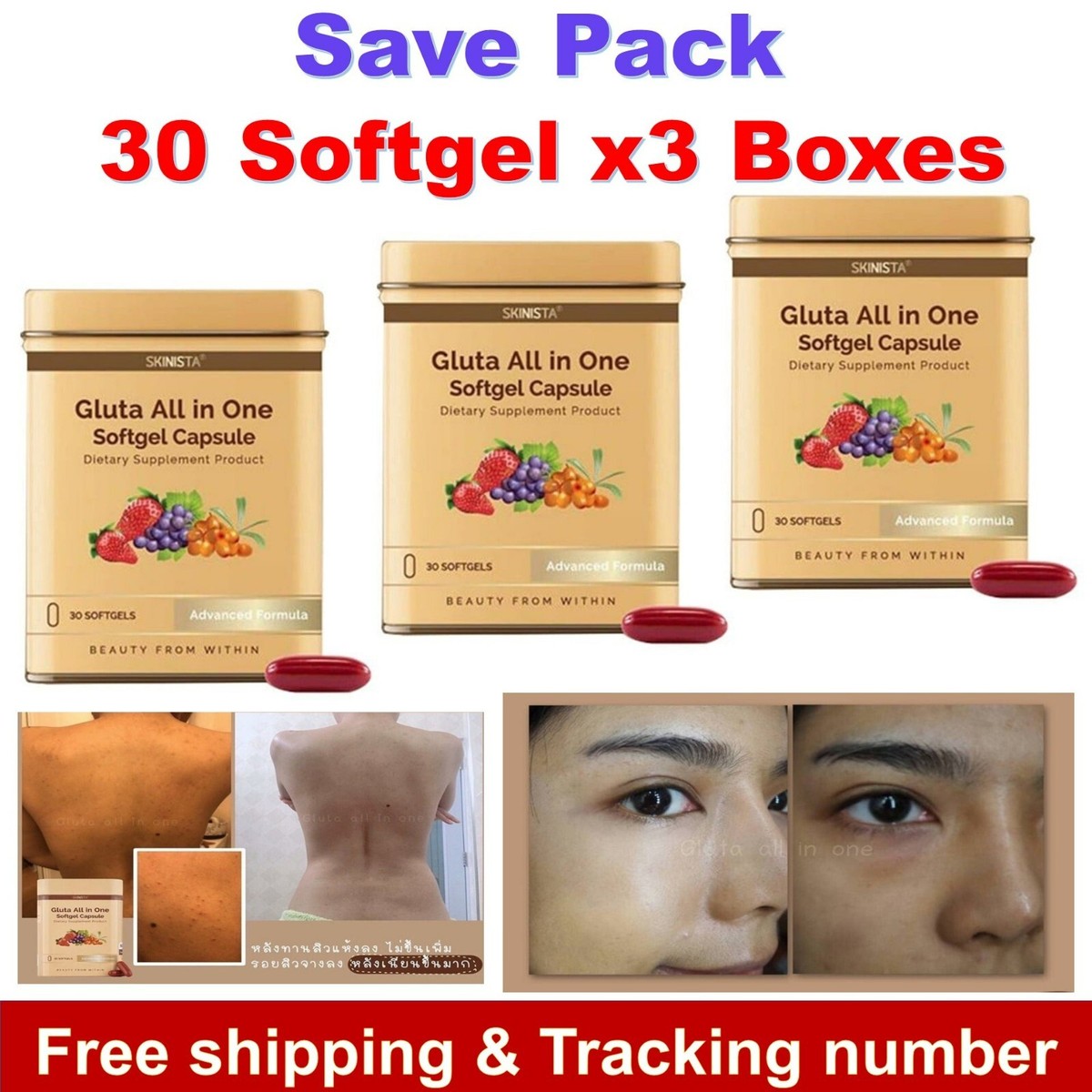 glutathion acne NAC Glutathione Skin Whitening Bleaching Anti-Agin Scar & Dark Spot Remover IV Glutathione Incident #LearnItOnTiktok #tiktokquiz