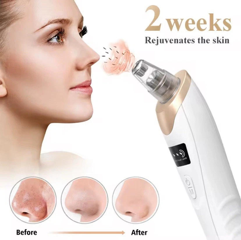 Electric Pore Cleaner - Blackhead Remover with Vacuum Cleaner + Attachments - Image 3 of 4