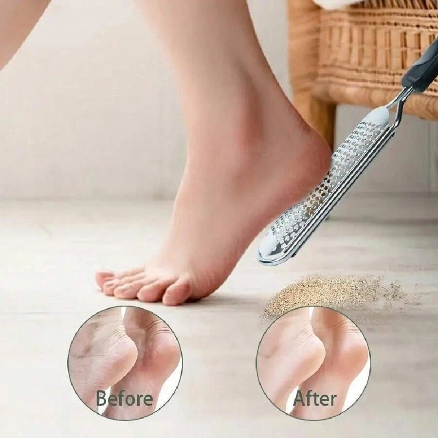 Stainless Steel Pedicure Foot File Callus Remover & Heel Scraper for Smooth Feet - Image 2 of 4