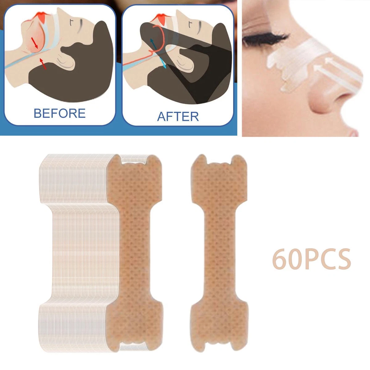 Best Nasal Strips For Deviated Septum In 2023
