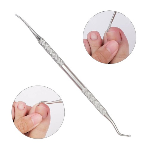 Ingrown Toe Nail File Double Ended Side Edges Lifter Kit Chiropody ...