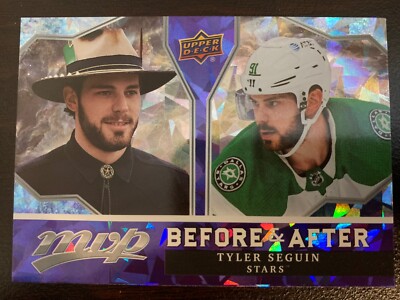 UPPERDECK MVP 2021-22 TYLER SEGUIN BEFORE AND AFTER HOCKEY CARD BA-3 DALLAS