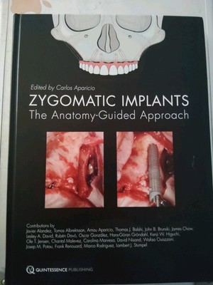 ZYGOMATIC IMPLANTS the Anatomy-Guided Approach Edited By Carlos Aparicio