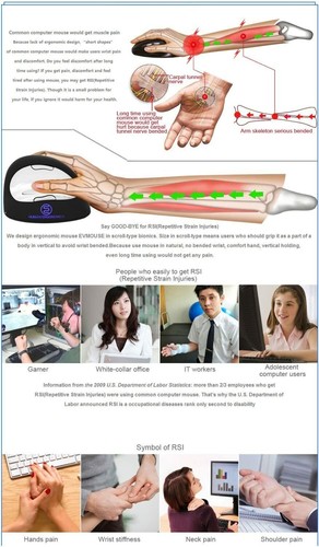 USB Wired Ergonomic Vertical Mouse DPI 500/1000/2000/2500 for PC - Picture 6 of 8