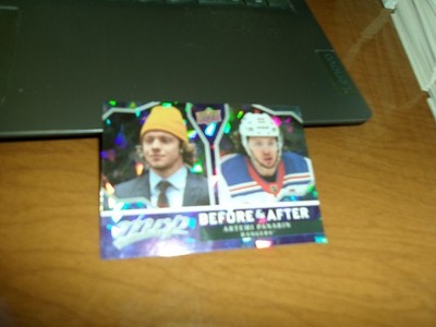 2021-22 UPPER DECK MVP BEFORE & AFTER INSERT #BA-8- ARTEMI PANARIN- RANGERS