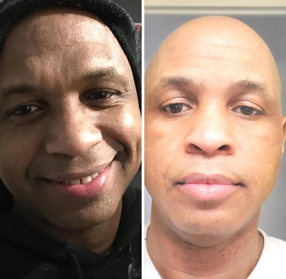 SKIN LIGHTENING TREATMENT:TRATAMIENTO EFECTIVO PARA BORRAR MANCHAS OSCURAS 2oz. - Image 2 of 4