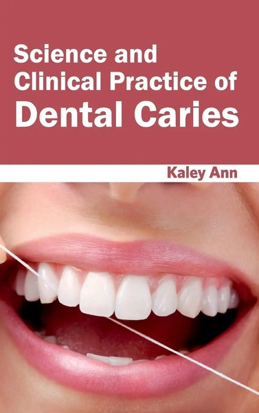 Kaley Ann | Science And Clinical Practice Of Dental Caries | Buch | Englisch-image
