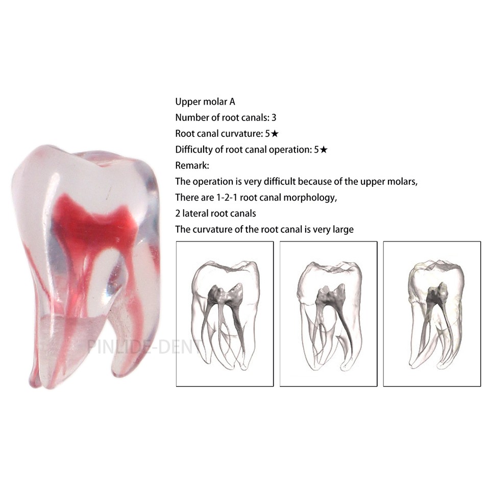 Dental Resin Root Canal Teeth Model Endo Practice Block RCT Pulp Cavity ...