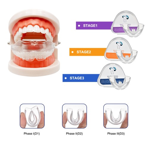3 Stage Dental Orthodontic Teeth Corrector Braces Retainer Alignment Trainer NEW - Picture 8 of 16