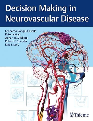 Decision Making in Neurovascular Disease Rangel–castilla Nakaji Siddiqui