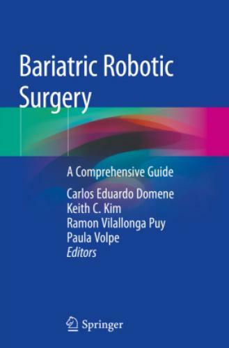 Thumbnail - Bariatric Robotic Surgery A Comprehensive Guide 6169