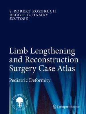 Limb Lengthening and Reconstruction Surgery Case Atlas: Pediatric Deformity by 