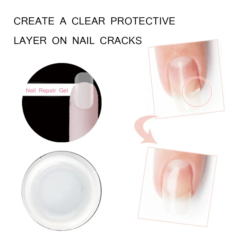 Orly Treatment - NAIL RESCUE KIT (Repair & Protect Cracked & Broken Nails)  23800 | eBay