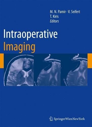Intraoperative Imaging by M. Necmettin Pamir, Volker Seifert,... - 9783709111093