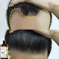 Ginger Herbal Shampoo - Hair Growth - Anti-Hair Loss - Anti-Itch - Anti-Dandruff