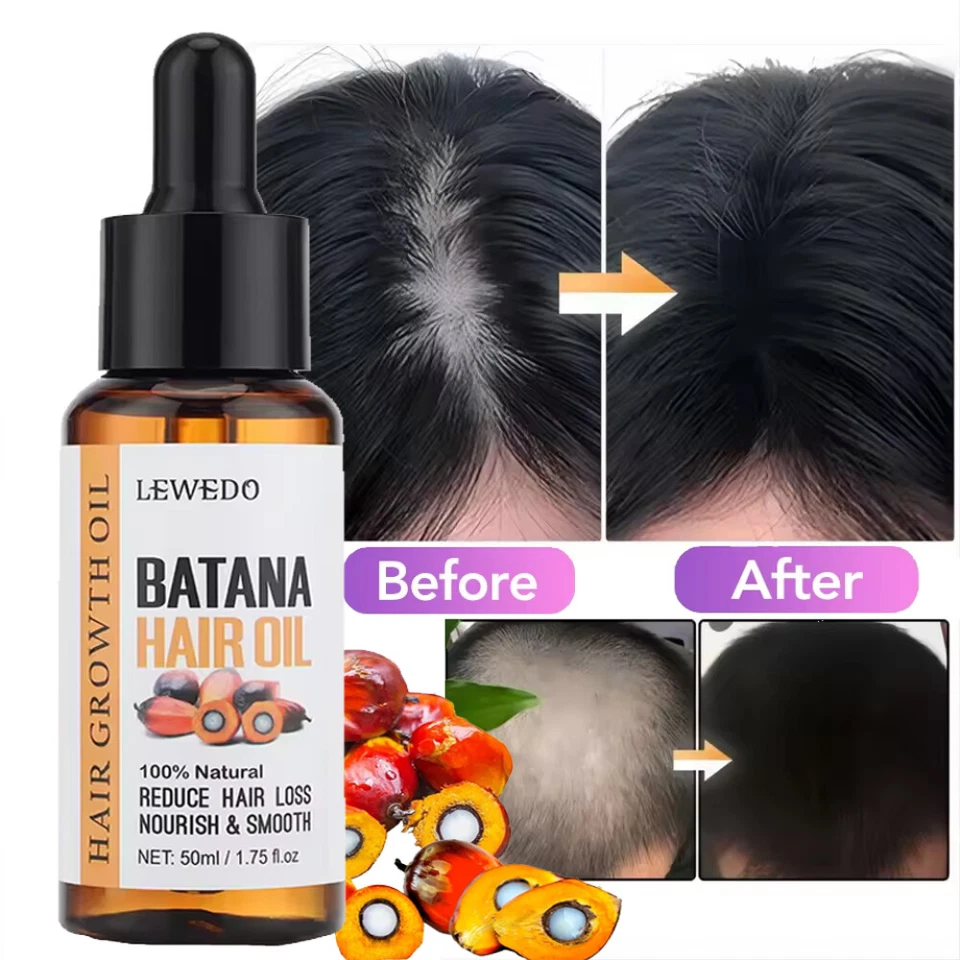LEWEDO Batana Oil For Hair Growth, Pure Natural Botana Oil Serum Hair Loss Treatment