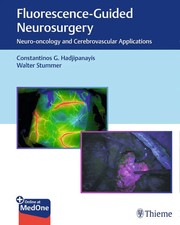Fluorescence-Guided Neurosurgery | Costas Had...