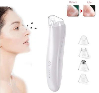 MARKENLOS Mitesser Entferner Porenreiniger Elektrisch Gesichts Black Head Vakuum Sauger