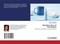 Maxillary Sinus & Pathologies Maxillary Sinus Pathologies, Imaging & Treatment