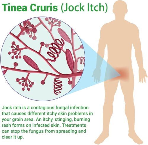 (2-PK) Advanced Jock Itch Cream, Powerful Solution for Tinea Cruris & Tinea Corp - Picture 6 of 6