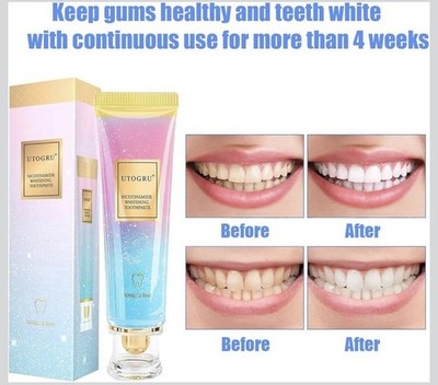 New Niacinamide Whitening Toothpaste, Utogru Teeth Radiant Whitening Toothpaste