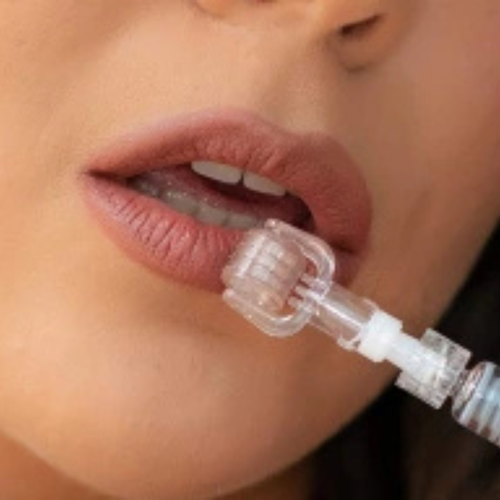 Micro 72 Needles 0.5mm Derma Aqua Roller Ampo Microneedling Tool Hydra Serum 3ML - Picture 3 of 4