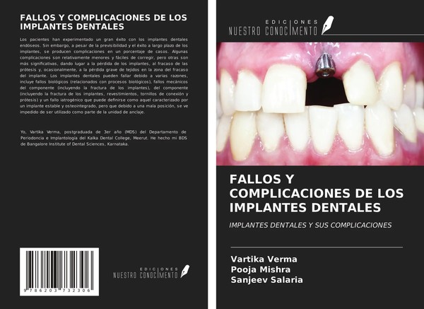 Vartika Verma (U. A.) | Fallos Y Complicaciones De Los Implantes Dentales | Buch-image