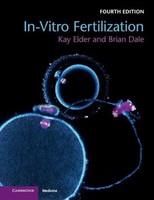 In-Vitro Fertilization Kay Elder (U. A.) Taschenbuch Kartoniert / Broschiert
