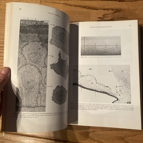 Principles & Practice Of Opthalmolgy By Peyman-Sanders- Goldberg Vol. 1 - 1980 - Picture 17 of 20
