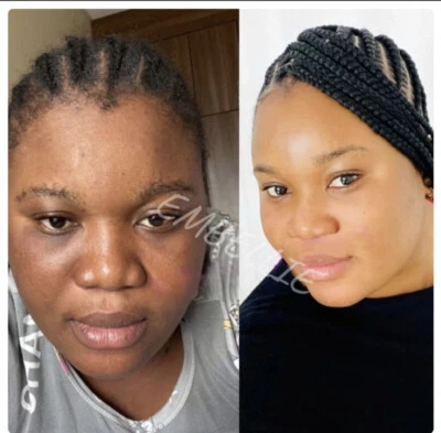 EMBELLIE SKINCARE Lightening Brightening face and body oil 100ml