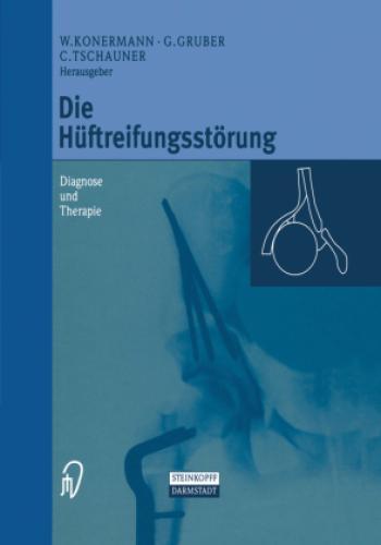Thumbnail - Die Hüftreifungsstörung Diagnose Und Therapie 2072