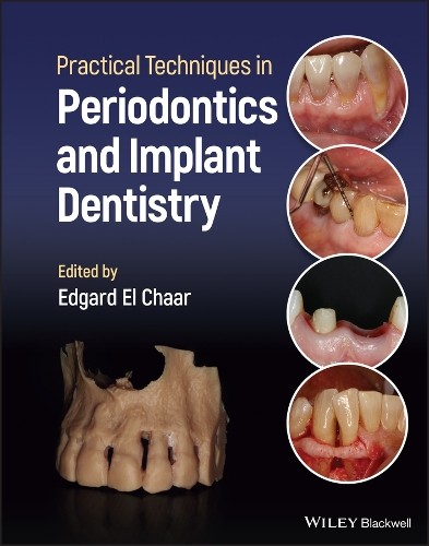 Practical Techniques in Periodontics and Implant Dentistry by Edgard El Chaar - Image 2