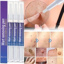 3Pcs 12 Hours Wart Remover Pen Skin Tag Mole Foot Corn Eliminate Warts Woman Man