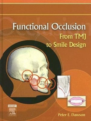 Functional Occlusion: From Tmj to Smile Design by Peter E Dawson: New