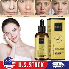 Anti-Wrinkle Firming Serum, Anti-Aging Lifting Essence, Wrinkle Lifting Essence