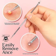 Stainless Blackhead Remover Tool Acne Blemish Needle Pimple Spot Extractor Pin