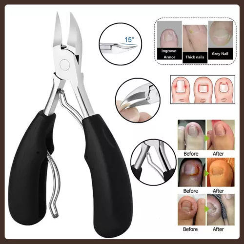 Nail Scissor Toenail Clipper Thick Ingrown Toe Nail Heavy Duty Precision BLACK - Bild 3 von 15