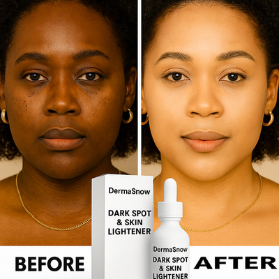 Derma Snow Whitening Face & Body Cream   Extra Strength Brightening Formula