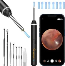 VITCOCO Ear Wax Removal Tool,Ear Cleaner with 1920P HD Camera,Ear Wax Removal Ki