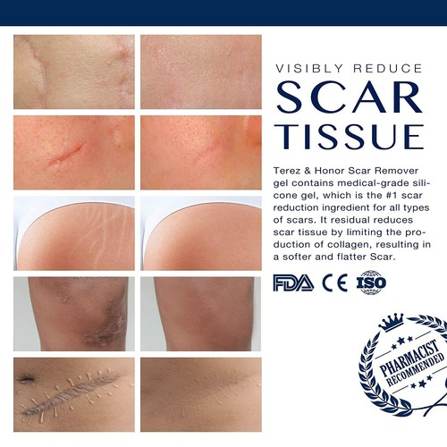 Scar Remover Gel for C-Section, Stretch Marks, Acne, Surgery, Old and New Scars - Picture 5 of 7