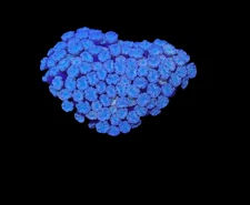 WYSIWYG Pink Alveopora Frag Live Coral – LPS for Saltwater Reef Aquarium
