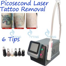 tattoo removal laser machine ND Yag picolaser picosecod carbon facial peel