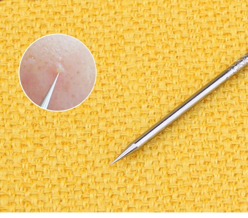 8pcs Blackhead Remover Extractor Tool Pimple Blemish Popper Comedone Kit Clip - Picture 6 of 10