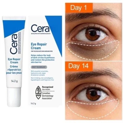 CeraVe Eye Repair Cream for Dark Circles & Puffiness with Hyaluronic Acid