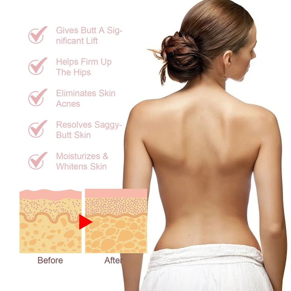 Rodillo de tratamiento de acné para rostro pecho espalda con vitamina E y manteca de karité 30 ml Foto 3 de 4